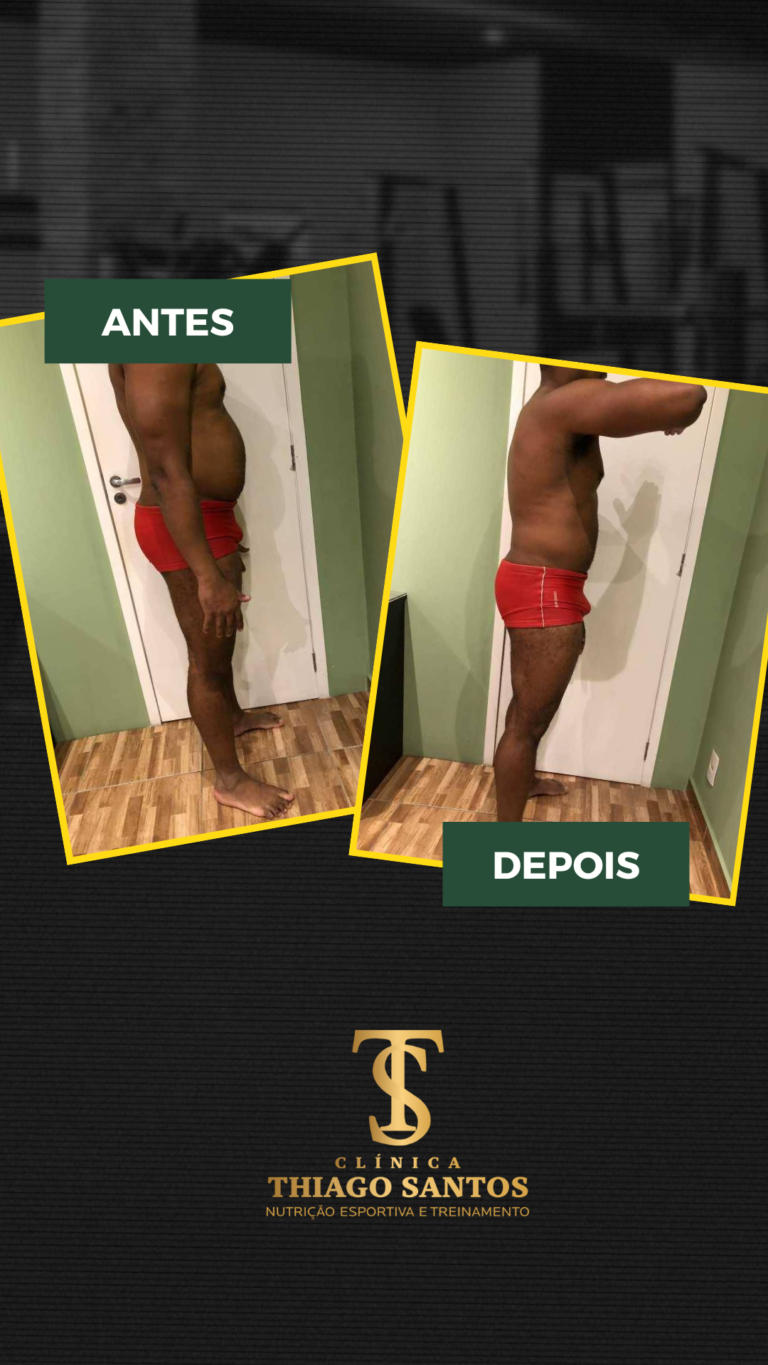 1. Alexander inacio - Antes e depois