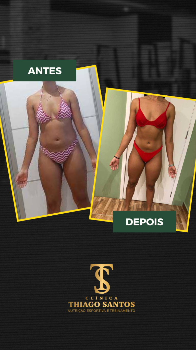 13.. Emily - Antes e depois