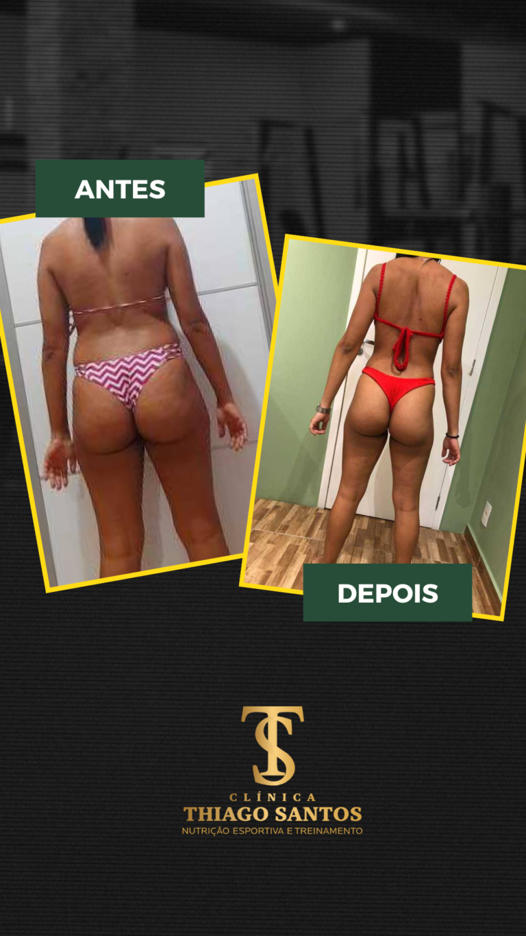 14.. Emily - Antes e depois
