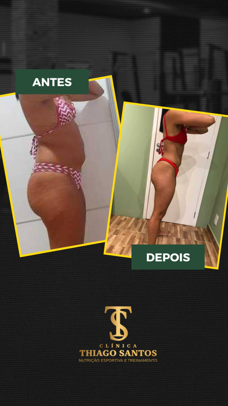 15. Emily - Antes e depois