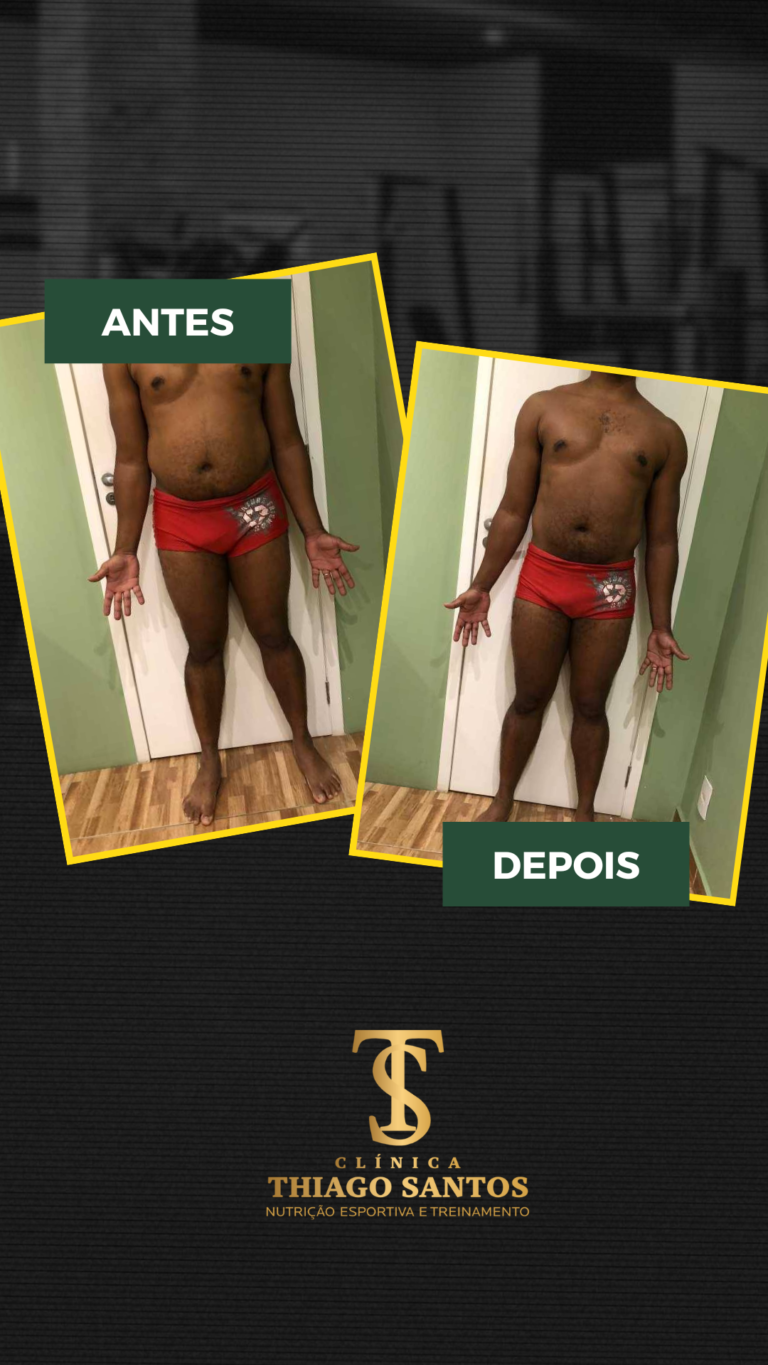 2. Alexander inacio - Antes e depois
