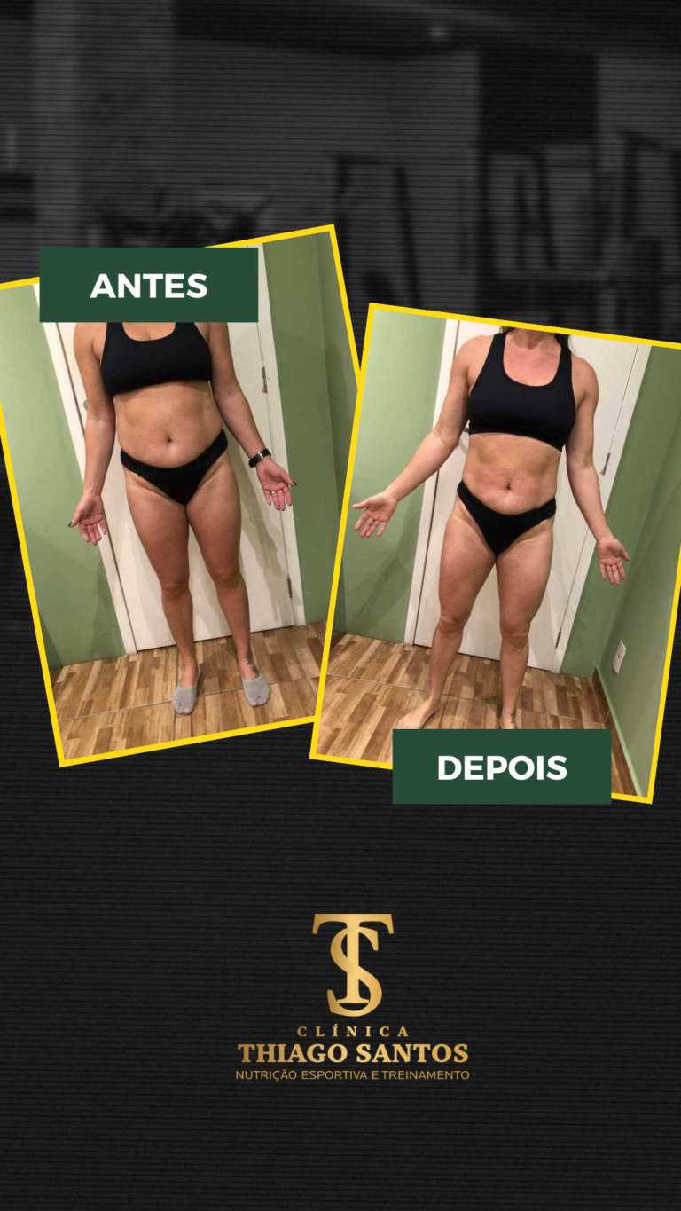 20. Sandra Regina - Antes e depois