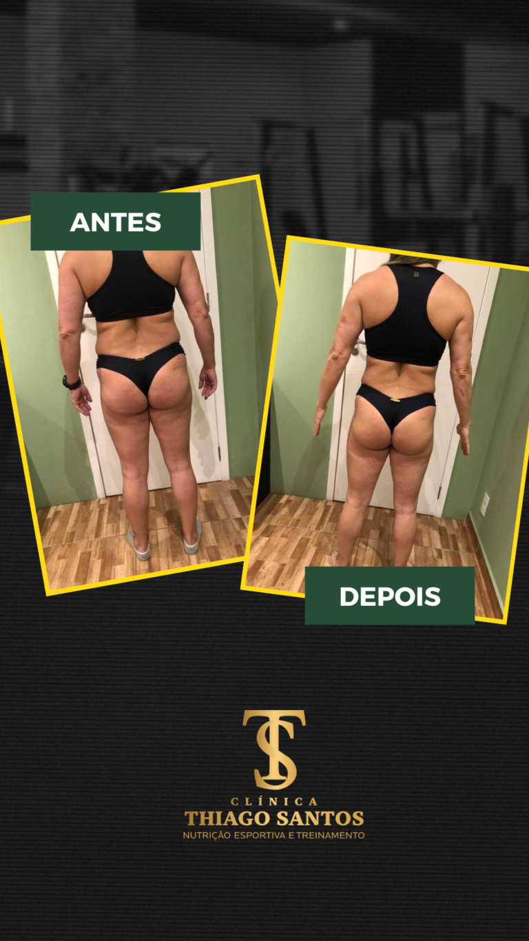 21. Sandra Regina - Antes e depois