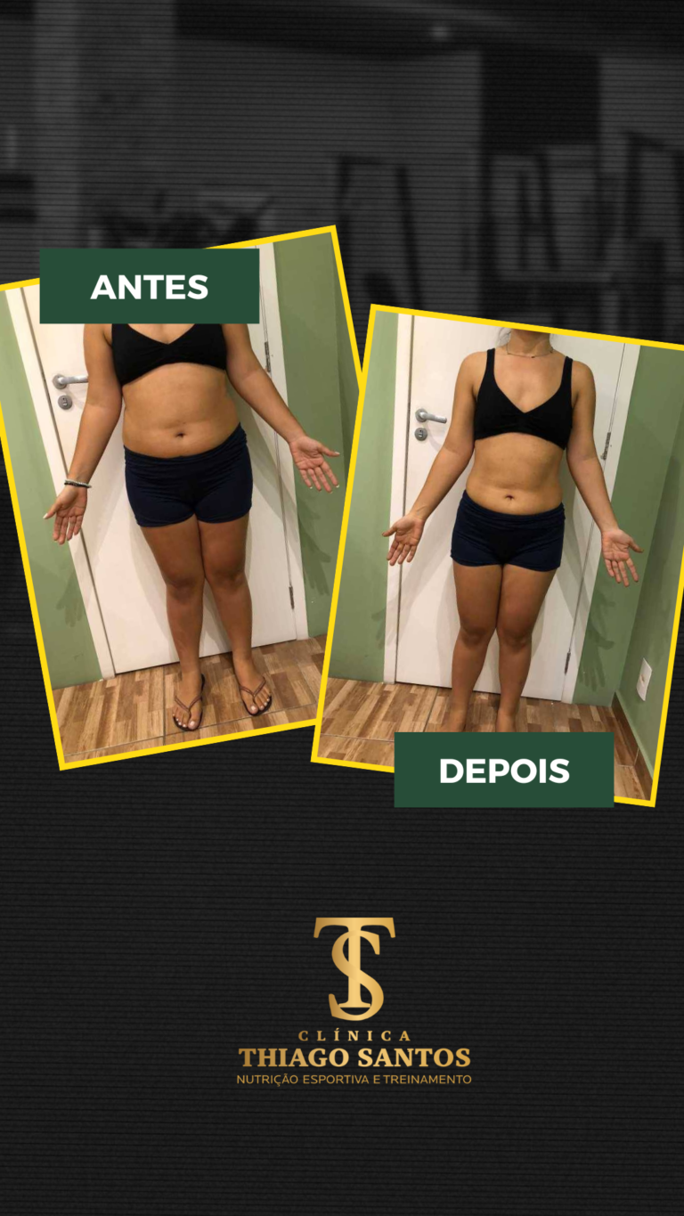 22. Fernanda - Antes e depois