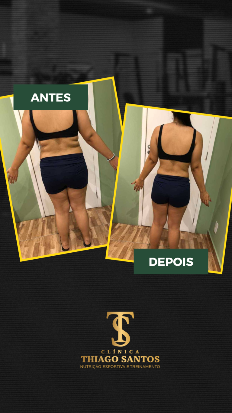 23. Fernanda - Antes e depois