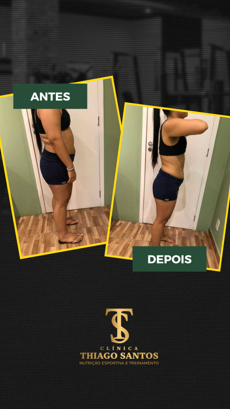24. Fernanda - Antes e depois