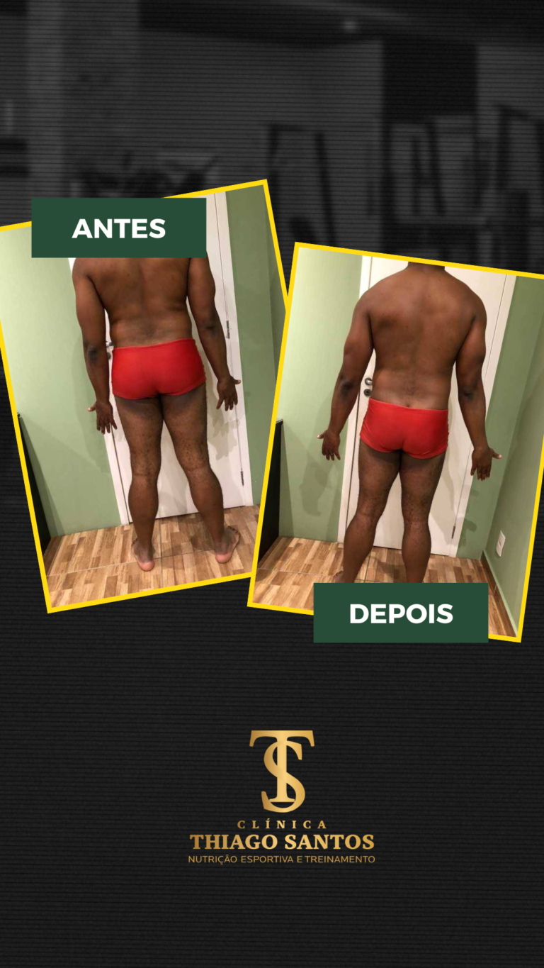 3. Alexander inacio - Antes e depois