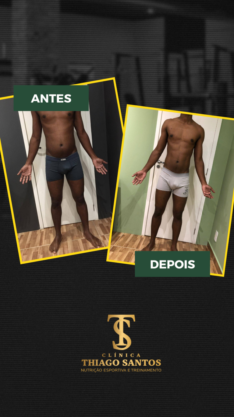 4. Luis Carlos - Antes e depois