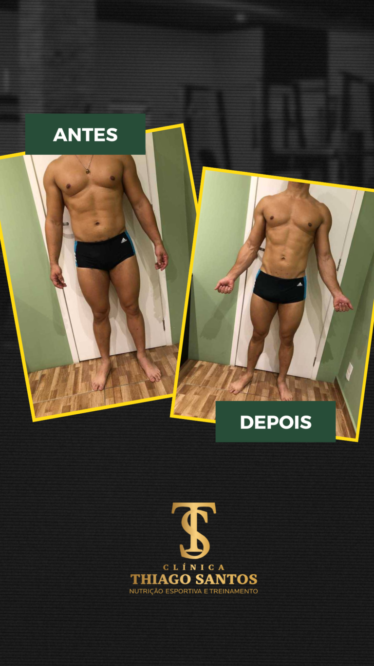 5. Rodrigo - Antes e depois