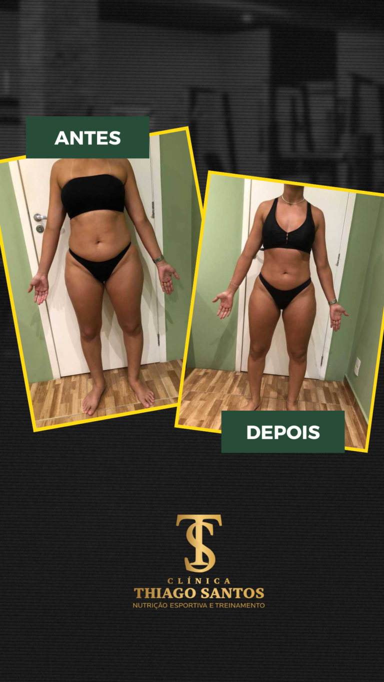 7. Daiana - Antes e depois