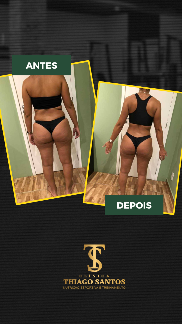 8. Daiana - Antes e depois