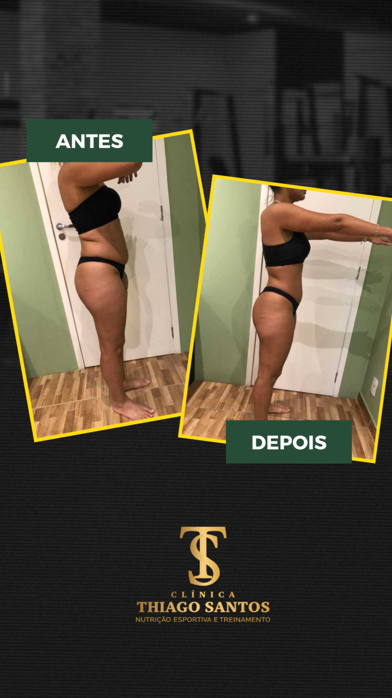 9.Daiana - Antes e depois